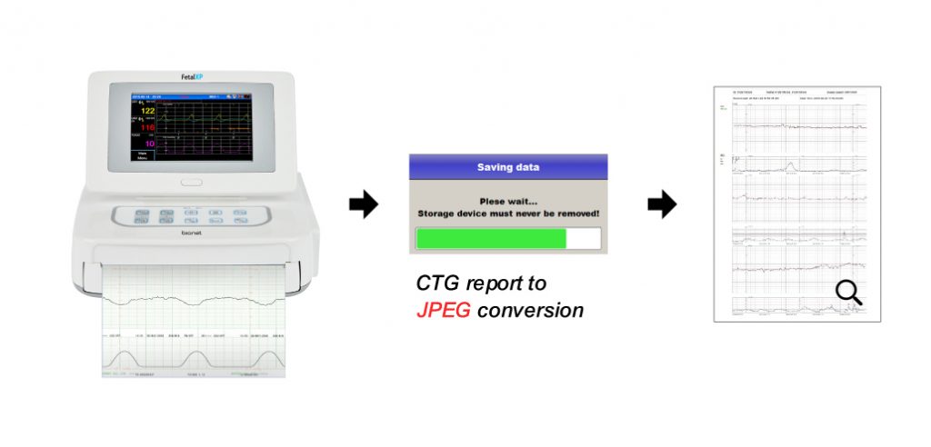 Respbuy-Bionet-FC1400-Fetal Monitor CTG to JPEG Bionet FC1400 Fetal Monitor (CTG Machine)