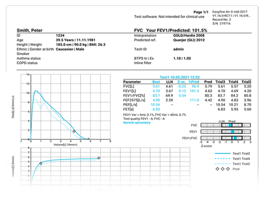 Respbuy_NDD_EasyOne Air_Spirometer Report NDD EasyOne Air Portable & PC Spirometer